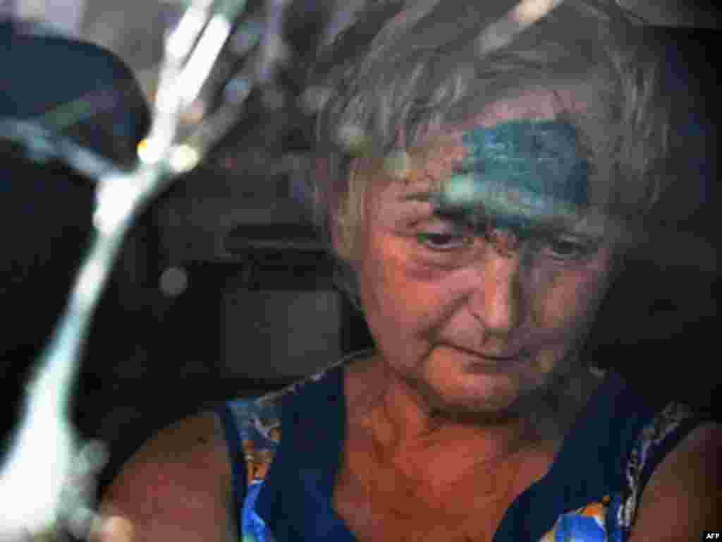 Раненая при обстреле грузинская женщина покидает Гори. 15 августа 2008 года.